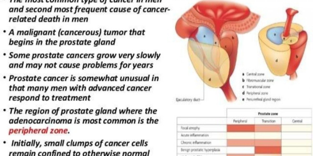 Prostate Cancer