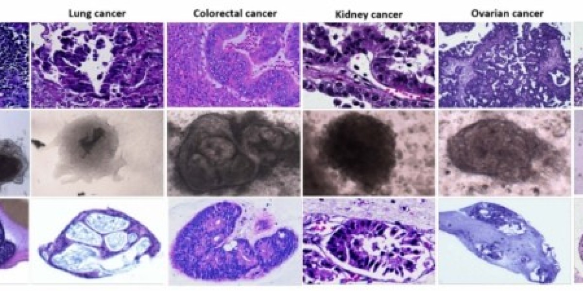 Innovative Organoid Culture Tools to Advance 3D Disease Modeling and Drug Discovery