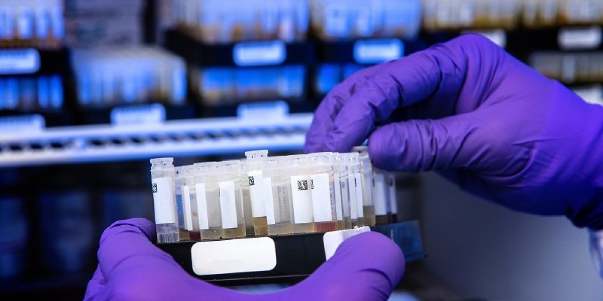 Beyond Static Structures: How NMR Spectroscopy Solves Biology's Toughest Dynamic Problems