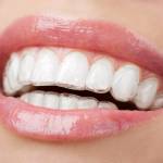 Invisible Braces Costs Profile Picture