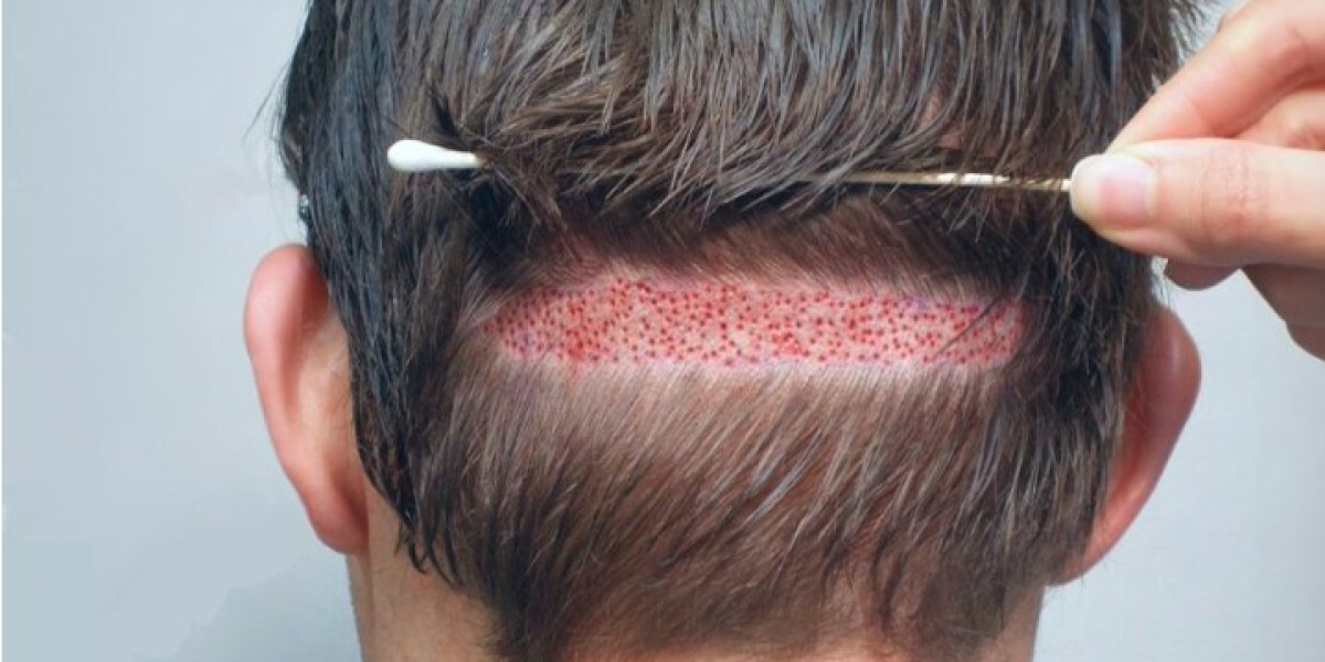 How to Choose the Right Hair Specialist in Lahore