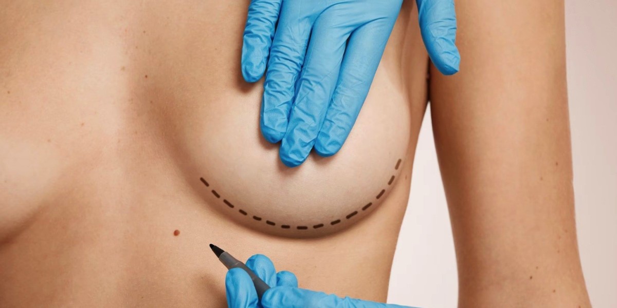 Breast Lift in Dubai vs. Breast Augmentation: Which Procedure Fits?